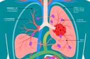 肺腺癌分期:肺腺癌一二三四期标准