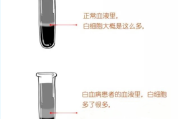 白血病群聊微信，白血病病友互助聊天群