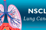 肺癌病友群聊:肺癌基因突变有哪几种?
