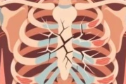 肺癌早期术后CT提示肋骨改变,需要做骨扫描排除骨转移吗？