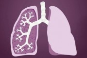 肺癌群科普,肺癌化疗药不良反应及处理