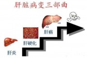 揭秘早期肝癌的9种征象