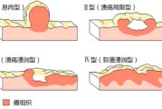 胃癌患者交流群,2021胃癌病友微信交流群,2022胃癌群一键加入