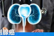 前列腺癌科学防治指南：了解风险、筛查与预防，守护男性健康