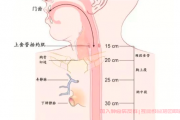 低分化食管癌化疗后适合TILS疗法吗？