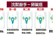 卵巢癌、输卵管癌原发性腹膜癌高危人群的筛查和预防建议