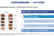 如何初步判断你的痣是否有风险？黑色素瘤诊断的系统检查流程