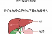 从胆结石到胆囊癌只需要三步！