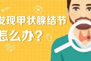 体检出甲状腺结节怎么办？会癌变需要切除吗？