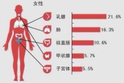 如何发现乳腺癌？得了乳腺癌能活多久？