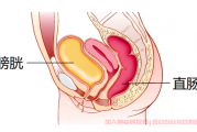 中低位直肠癌术后对排尿排便有影响吗？