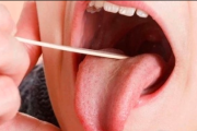舌癌术后加什么群？如何借助群体支持加速恢复