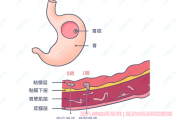 得了胃癌一定要积极治疗，也能治愈概率很高