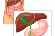 壶腹部癌症群：了解病因、症状与治疗方案