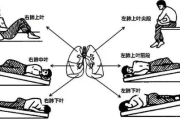 肺癌术后康复必备：科学护理与训练