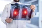 肺癌早期有三处痛，说明体内有癌细胞了