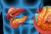 胰腺癌群答疑,胰腺癌化疗后的副作用该怎么处理？