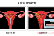 子宫内膜癌QQ群加入，在线社群抗击病魔的温暖港湾