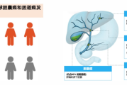 应对胆道癌类型科普：多学科综合治疗的必要性