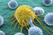 子宫内膜癌的异常症状表现和子宫内膜癌预防