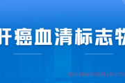 肝癌标志物的检测,诊断原发性肝癌的血清标志物