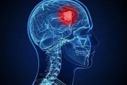 生活中哪些症状和信号是说明得了脑瘤？