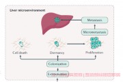 胃癌转移肝,可以用射频消融治疗吗？