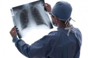 肺癌家属交流微信群：肺癌患者千万别手术？