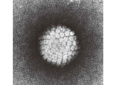 口腔容易感染hpv吗?怎样确定口腔内感染hpv