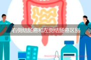 右侧与左侧结肠癌的临床特征对比，有什么区别?