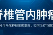 脊椎管内肿瘤5公分伴马尾神经受损变形，如何治疗与康复？