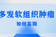 软组织肿瘤与多发性骨髓瘤如何区别？