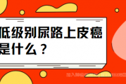 低级别尿路上皮癌是什么,病友群病情讨论