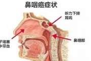 鼻咽癌该如何治疗，预后注意什么？