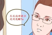 急性阑尾炎患者手术后病检报告引发的神经内分泌细胞瘤疑问