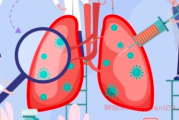 肺腺癌3A期患者能否联合服用奥希替尼和类风湿药物来治疗？肺腺癌晚期抗癌群问答
