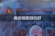 加入癌症晚期微信群：共同战胜绝症的希望