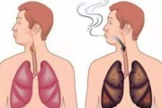 肺癌为什么会成为中国第一大癌？