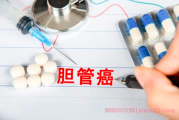 治疗胆管癌的药物有哪些？胆管癌治疗新进展