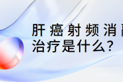 肝癌资深患者交流群,肝癌射频消融治疗是什么？