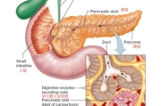 胰腺神经内分泌肿瘤和胰腺癌的区别？