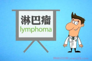 淋巴癌抗癌群，淋巴瘤病友的微信群真实加入方式