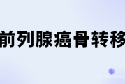 前列腺癌病友群答疑,前列腺癌骨转移会发生吗？