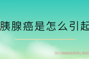 真实胰腺癌交流抗癌群,胰腺癌是怎么引起的？