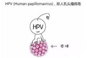 HPV病毒的感染就会得宫颈癌吗