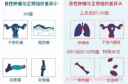 良性肿瘤与恶性肿瘤的区别？肿瘤如何治疗？