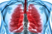 肺鳞癌转移后该这么办，能活多久呢？