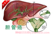 友情共济——肝门胆管癌病友群的互助精神