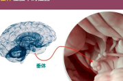 垂体瘤复发，需终止哺乳期并手术切除吗？