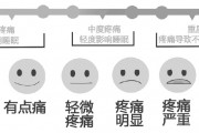 癌症患者有癌痛的止疼药怎么吃，会有依赖成瘾吗？